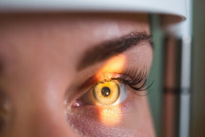 schlaganfall im auge