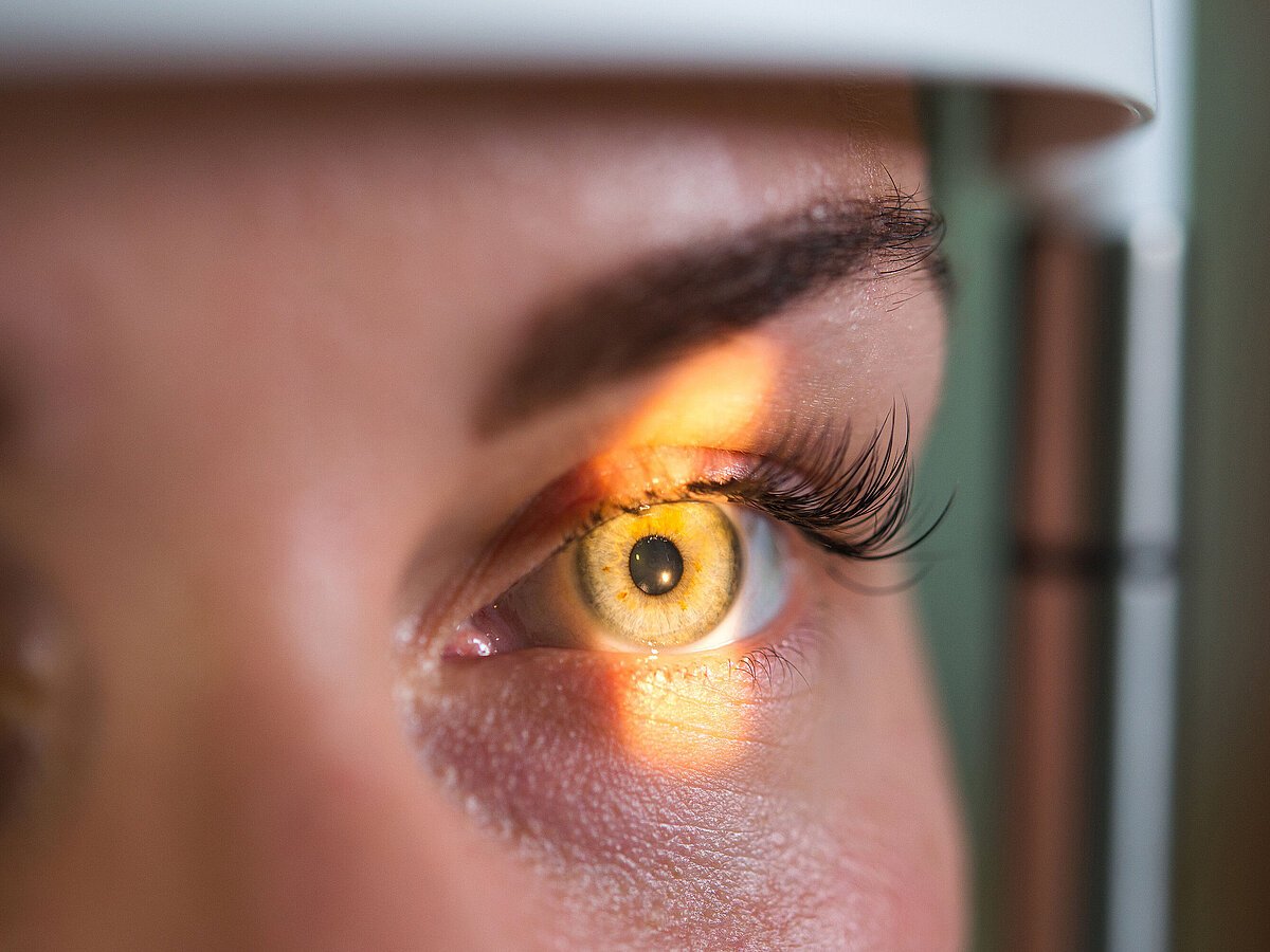 schlaganfall im auge